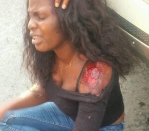 Lady appreciates God for surviving fatal accident.dailyfamily.ng