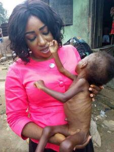 16-year-old girl and her malnourished daughter now in good shape.dailyfamily.ng