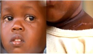 2-year-old girl survives wound from stray bullet during protests in Kenya.dailyfamily.ng