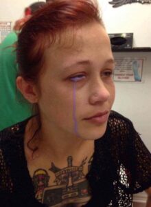 Female model gets eye damaged after undergoing eye tattoo -dailyfamily.ng