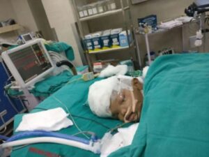 Doctors in India Separates twins conjoined in the skull -dailyfamily.ng