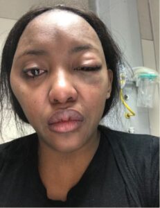 Lady allegedly beaten by man over parking space seeks Justice.dailyfamily.ng