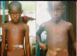 See Nigerian 4-year-old girl, Favour Lawal born without anus.dailyfamily.ng
