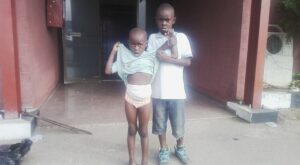 See Nigerian 4-year-old girl, Favour Lawal born without anus.dailyfamily.ng