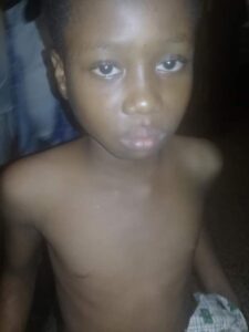 Woman allegedly attacks her 8-year-old maid with hot knife (Graphic Photos).dailyfamily.ng