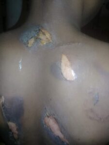 Woman allegedly attacks her 8-year-old maid with hot knife (Graphic Photos).dailyfamily.ng
