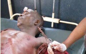 Man allegedly kill brother over piece of land [Viewers discretion]-dailyfamily.ng