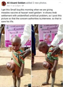 See little boy with Unidentified Umbilical Cord in Yobe.dailyfamily.ng