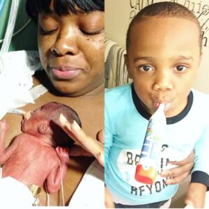 Woman shares photo of her premature baby now four-years-old.dailyfamily.ng