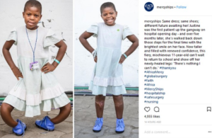 11-Year-Old Girl’s Bow Leg Becomes Straight After Surgery (Photos).dailyfamily.ng
