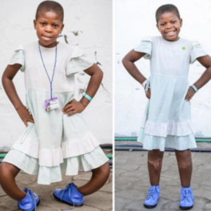 11-Year-Old Girl’s Bow Leg Becomes Straight After Surgery (Photos).dailyfamily.ng