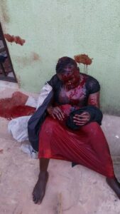 Man Attacks Wife With Machete, Kills Himself later (Graphic Photo).dailyfamily.ng