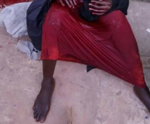 Man Attacks Wife With Machete, Kills Himself later (Graphic Photo).dailyfamily.ng