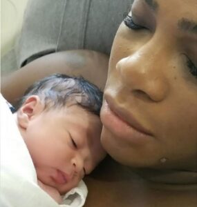 Famous Tennis Star, Serena Williams Reveals How She "almost died" After childbirth-dailyfamily.ng