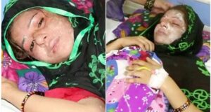 Man Pours Acid on Wife for Giving Birth to Baby Girl (Graphic Photos).dailyfamily.ng