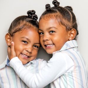9 Amazing Kinds of Twins You Never Imagine Exist-dailyfamiy.ng