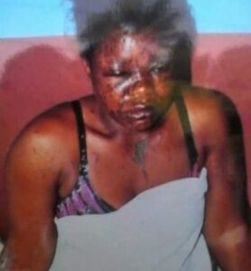 Man Pours Acid on His Niece and Her Lover, See Reason2.dailyfamily.ng