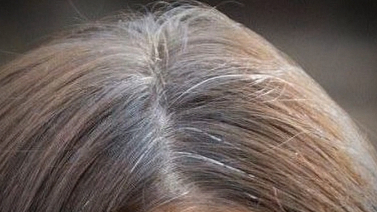 See Why Gray hair is Linked with Immune System Activity, Viral Infection –  Daily Family