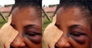 Married Man Beats Lover to Stupor For Visiting Him Unannounced.dailyfamily.ng