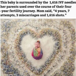 Baby Surrounded By Over 1000 Needles In Strange Photo.dailyfamily.ng