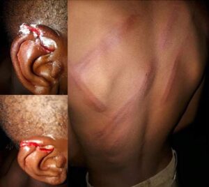 Man Cuts Son’s Ear With Blade.dailyfamily.ng