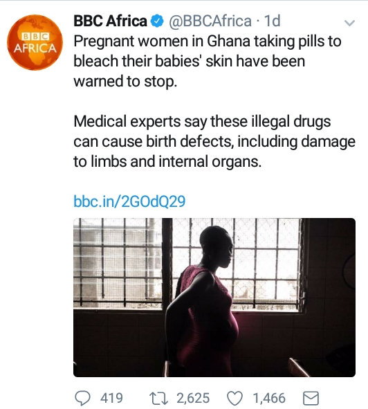 Strange! Women Now Bleach Babies’ Skin in Pregnancy (Full Details)