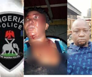 UPDATE: Police Arrest Man Who Beats His Wife To Pulp And Post The Pictures Online-dailyfamily.ng