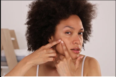 4 habits that will make your pimples problem worse 